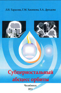 Субпериостальный абсцесс орбиты