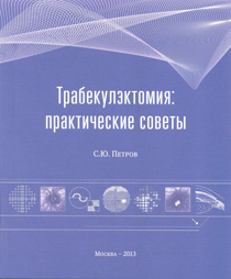 Трабекулэктомия: практические советы