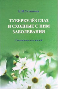 Туберкулез глаз и сходные с ним заболевания