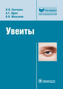 Увеиты