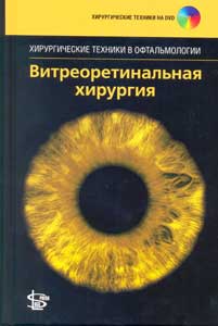 Витреоретинальная хирургия