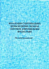 Візуалізація субретинальних неоваскулярних мембран способом довгохвильової фундусграфії