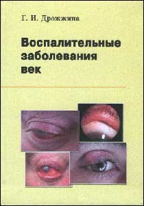 Воспалительные заболевания век