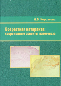 Возрастная катаракта: современные аспекты патогенеза