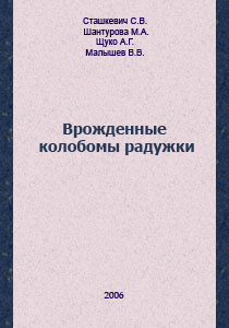 Врожденные колобомы радужки