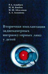 Вторичная имплантация заднекамерных интраокулярных линз у детей