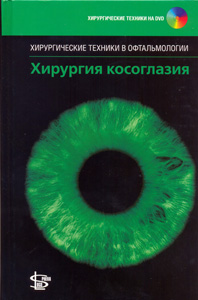 Хирургия косоглазия