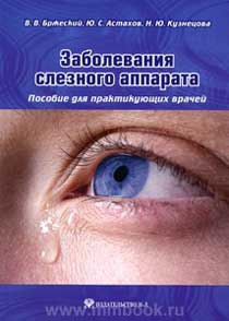Заболевания слезного аппарата. Пособие для практикующих врачей