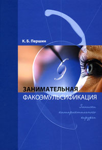 Занимательная факоэмульсификация. Записки катарактального хирурга